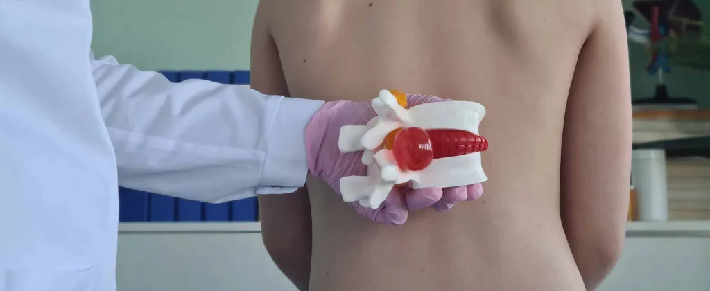 Межпозвоночная грыжа у детей