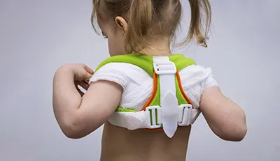 Лечение лордоза у детей Лечение лордоза у детей